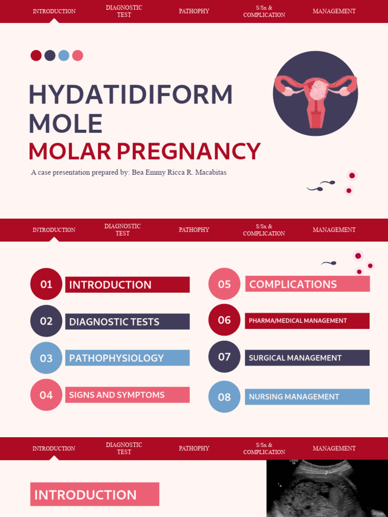 Molar Pregnancy | PDF | Pregnancy | Medical Specialties