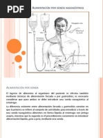 Alimentación Por Sonda Nasogástrica