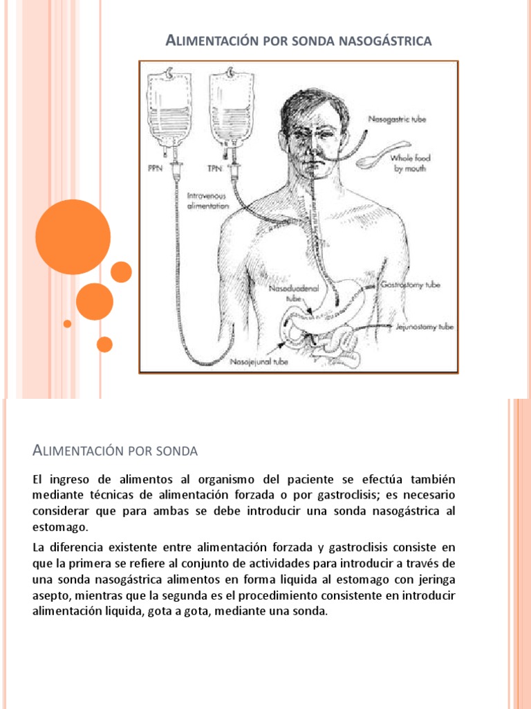 alimentaci-n-por-sonda-nasog-strica-pdf