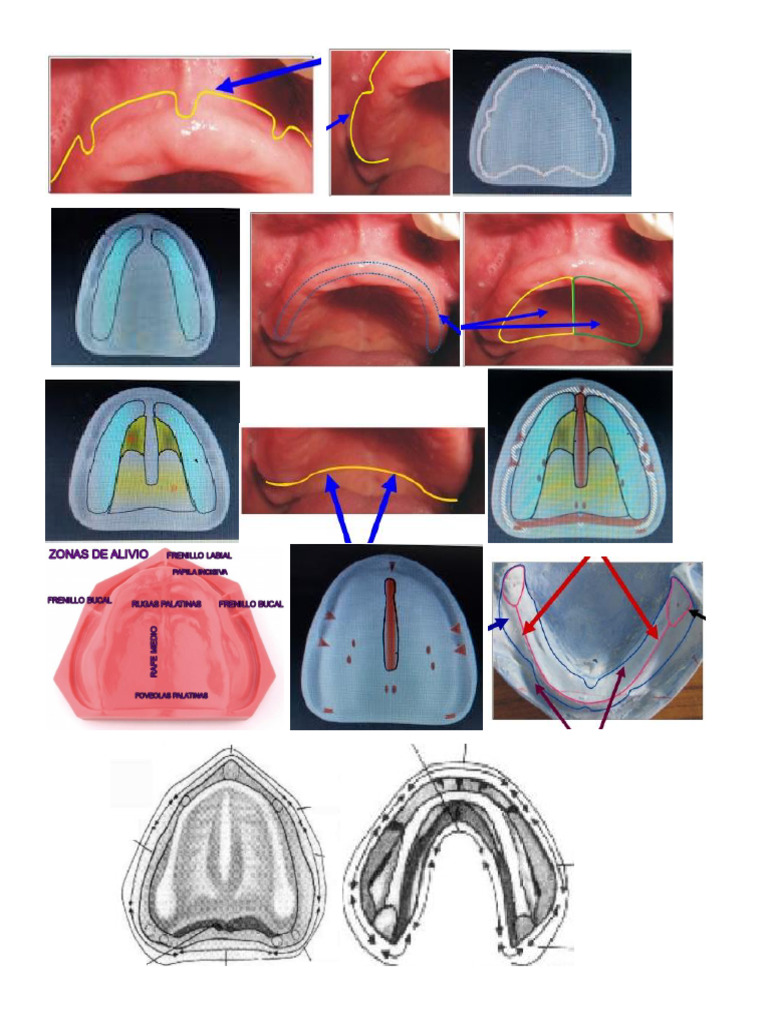 Anatomia Edentula | PDF