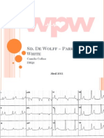 SD Wolff - Parkinson - White