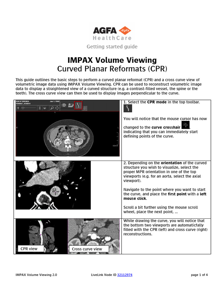 IMPAX Volume Viewing CPR Guide | PDF | Software | Computing