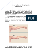 Lifting de Bracos Ou Braquial