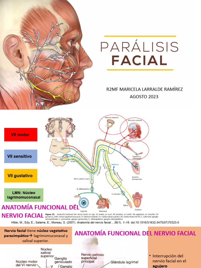 Parálisis Facial PDF Nervio Sistema nervioso