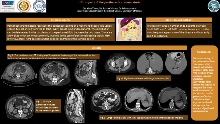 CT Findings in Peritoneal Carcinomatosis | PDF | Ovarian Cancer ...