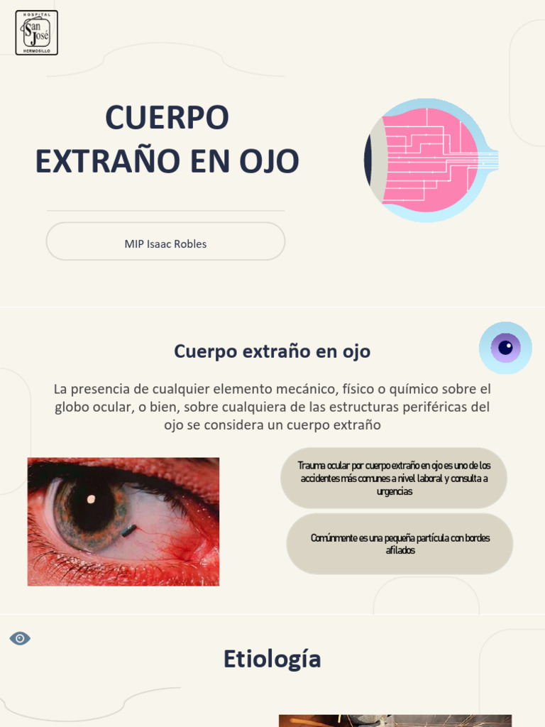 cuerpo-extra-o-en-ojo-gu-a-completa-pdf-ojo-humano-oftalmolog-a