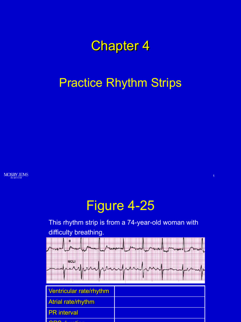 Practice Rhythm Strips Analysis | PDF | Electrocardiography | Heart Rate