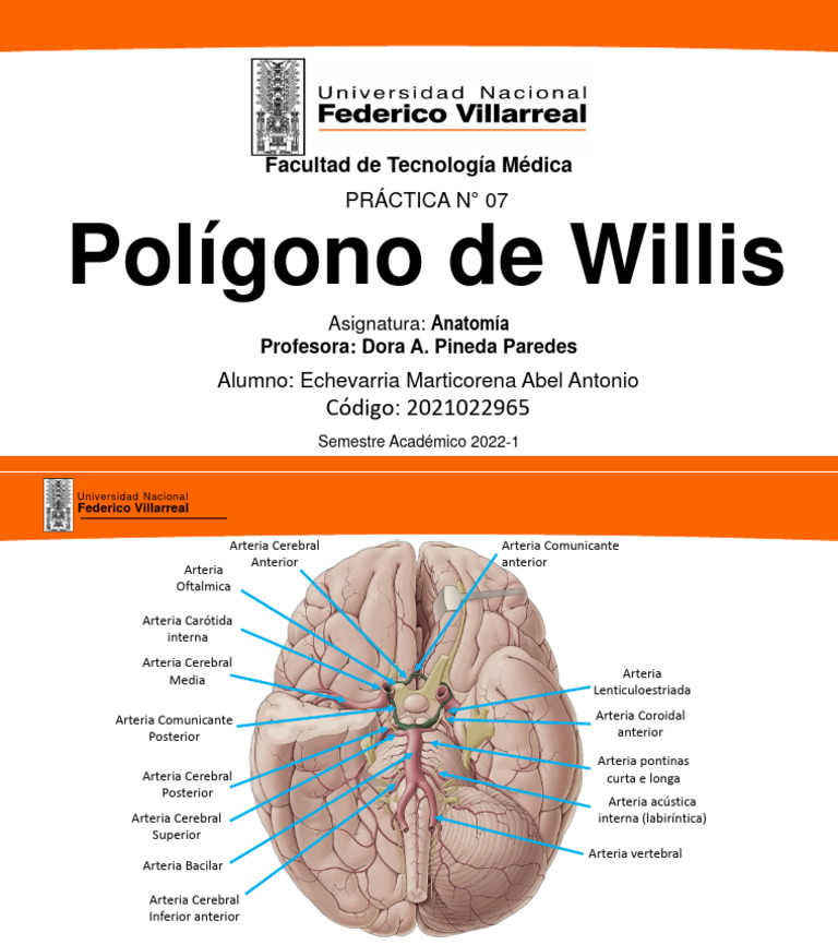 Polígono de Willis - Abel Echevarria | PDF