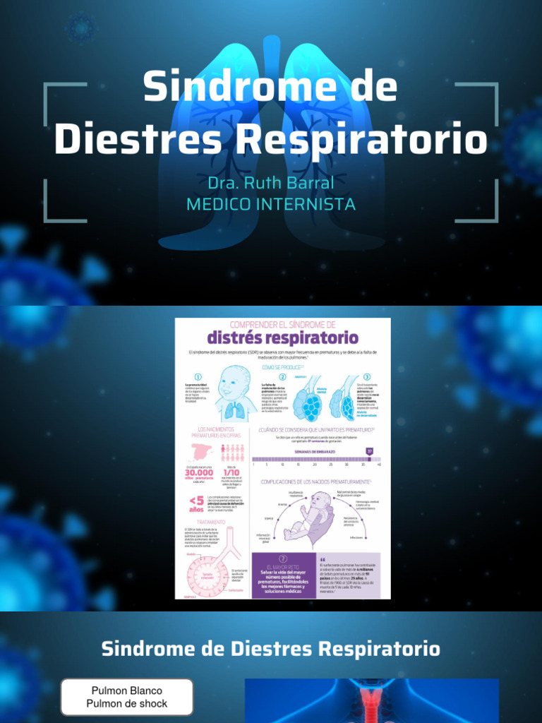 2.2 Sindrome de Distres Respiratorio Agudo | PDF | Edema | Inflamación