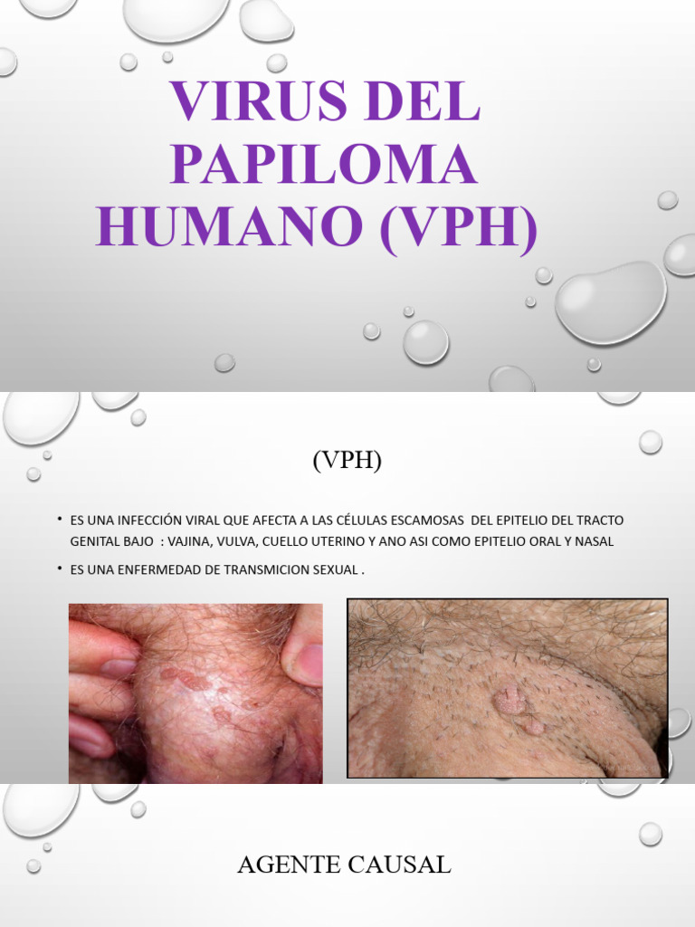 Infección por VPH: Síntomas y Prevención | PDF
