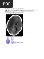 Download Stroke by Frans Aang SN74598219 doc pdf