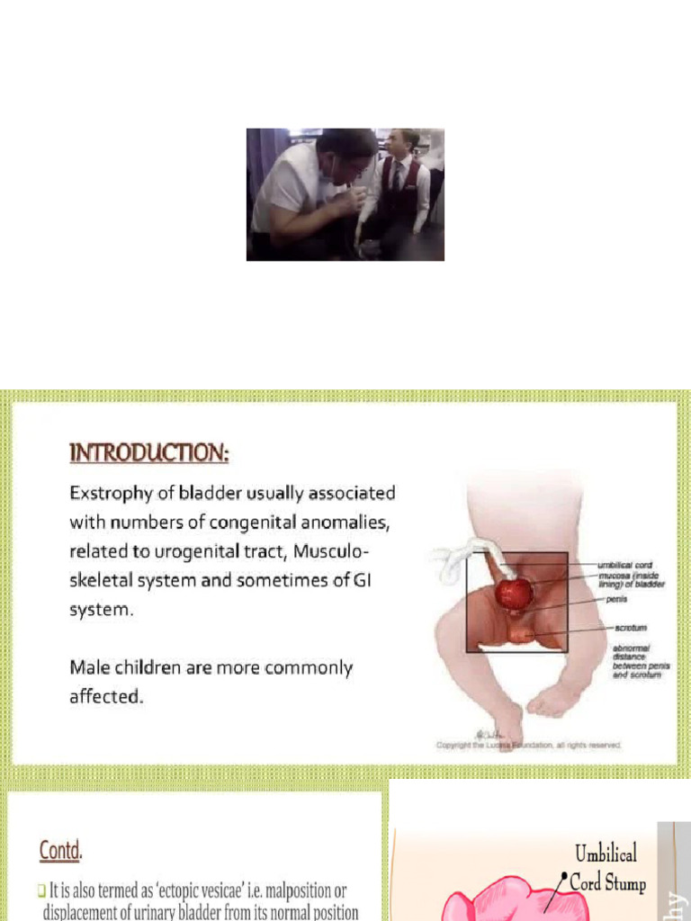 Bladder Emergency at Birth | PDF | Wellness | Science & Mathematics