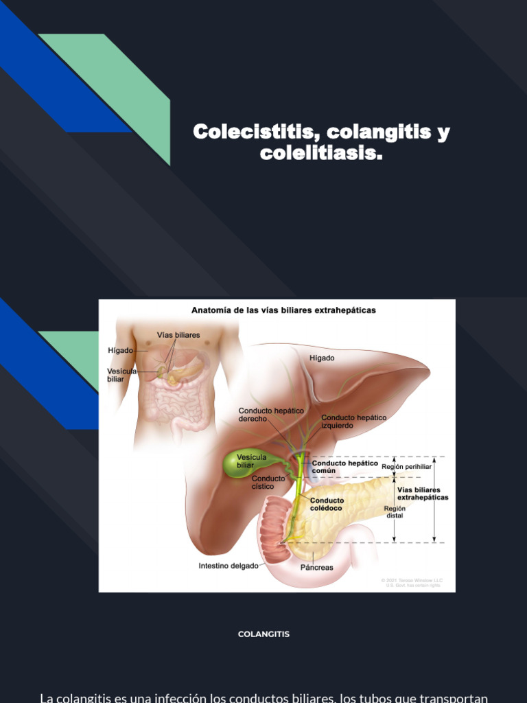 Colecistitis, Colangitis y Colelitiasis | PDF | Bilis | Vesícula biliar