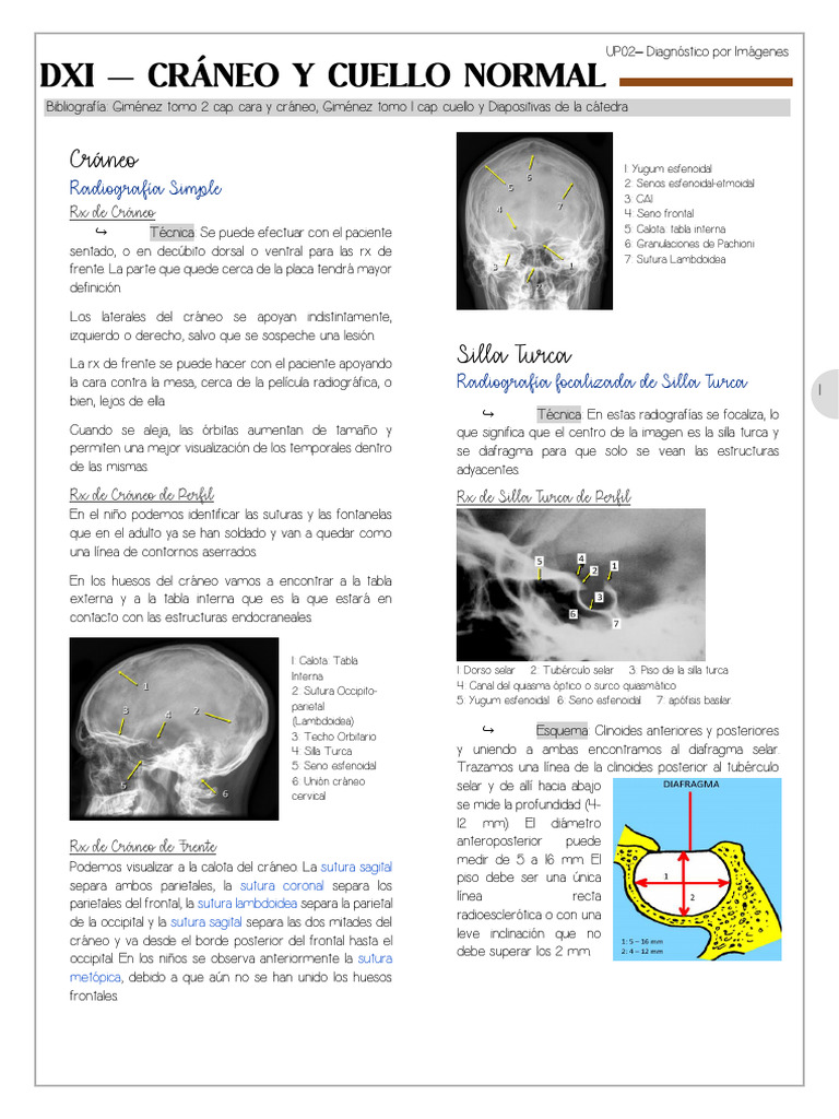 UP2. Cráneo y Cuello Normal DxI | PDF | Ct Scan | Cráneo