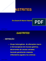 Gastrites: causas, tipos e tratamento