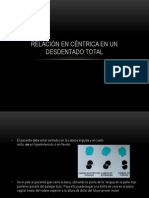 Relación en Céntrica en Un Desdentado Total