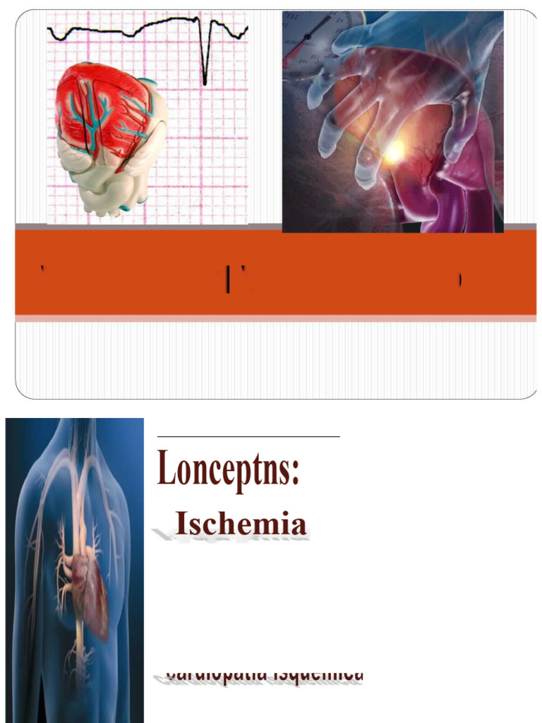 Ischemic Heart Disease | PDF | Myocardial Infarction | Coronary Artery ...