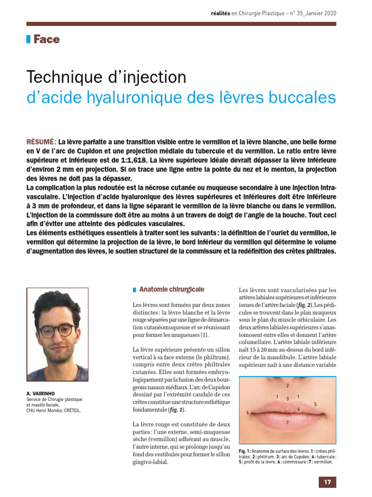 Techniques d'injection des lèvres | PDF | Lèvre | Anatomie humaine