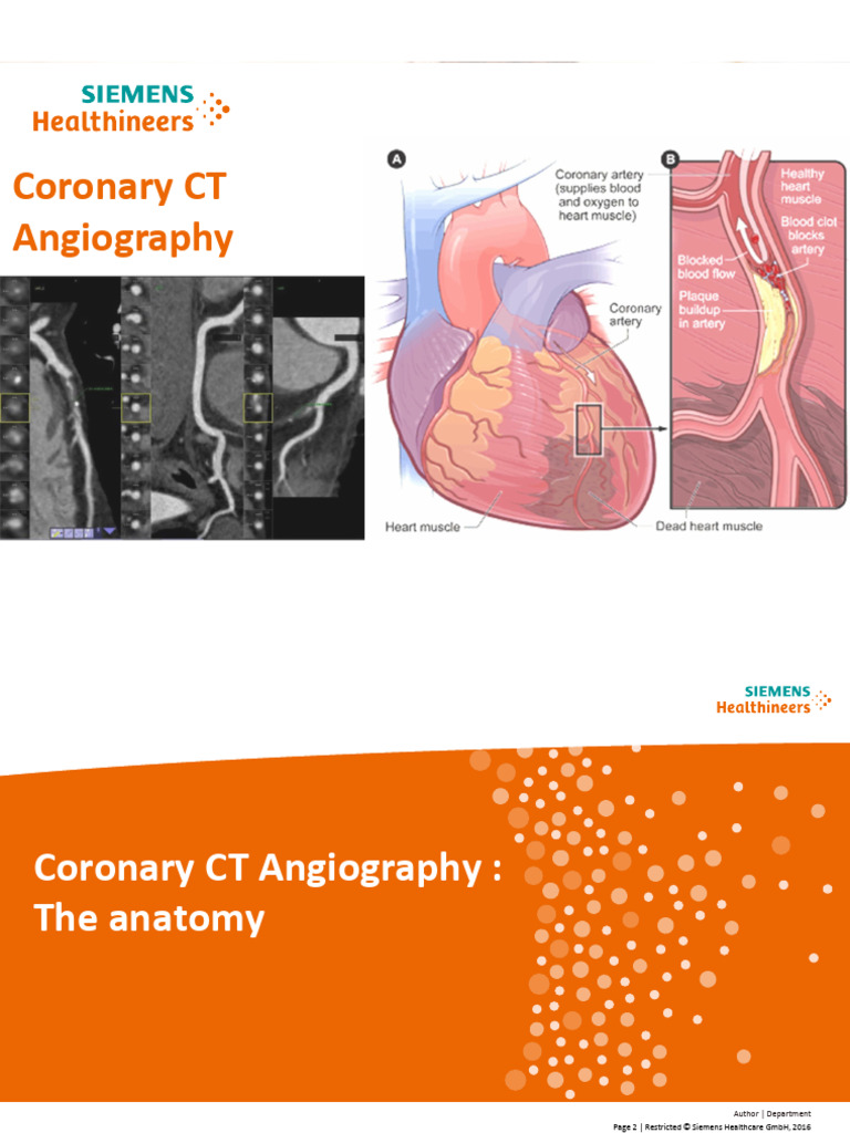 CT Coronary | PDF | Coronary Circulation | Heart