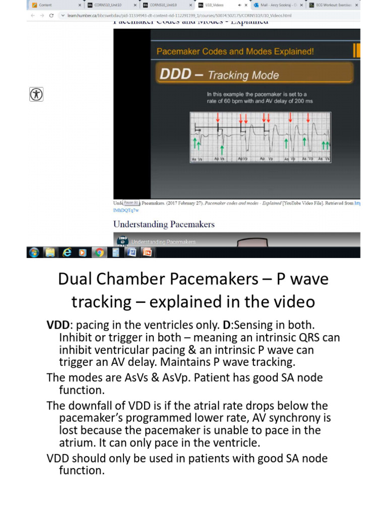 Understanding Dual Chamber Pacemakers | PDF