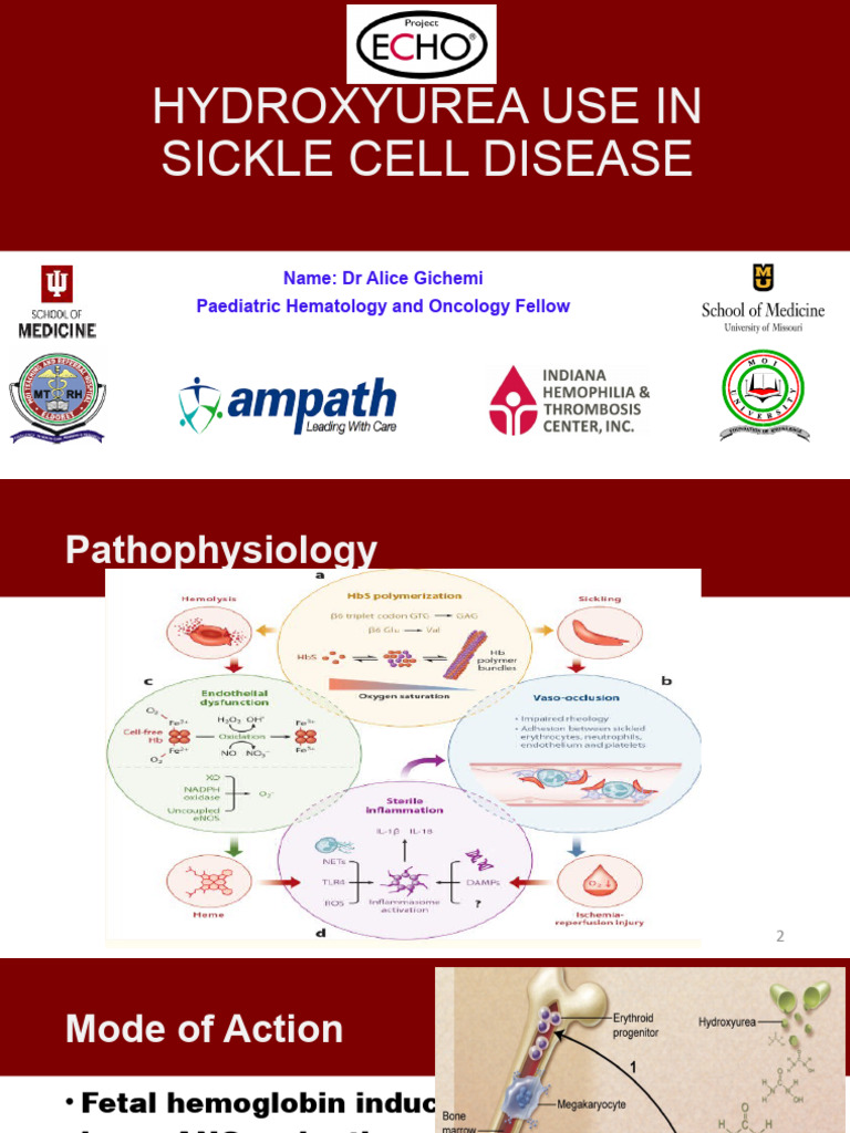 Hydroxyurea in Sickle Cell Treatment | PDF | Anemia | Drugs