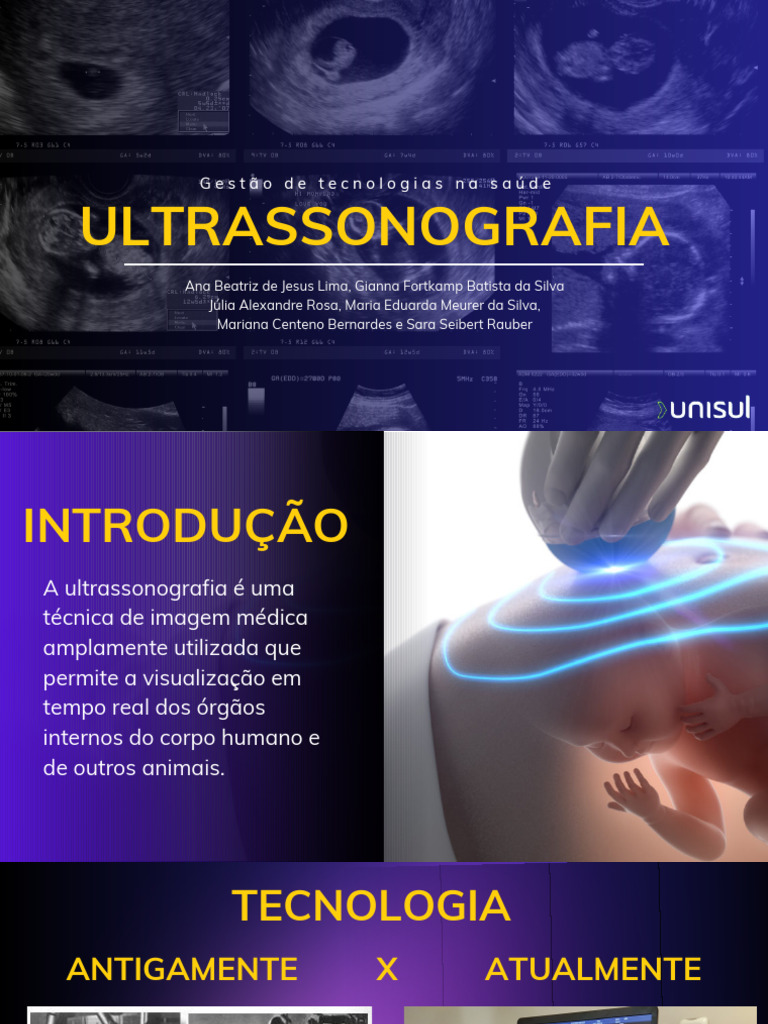 Tecnologias de Ultrassonografia na Saúde | PDF | Ultrassom médico ...