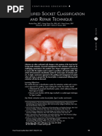 Cairo Classification of Gingival Recession | PDF | Periodontology ...