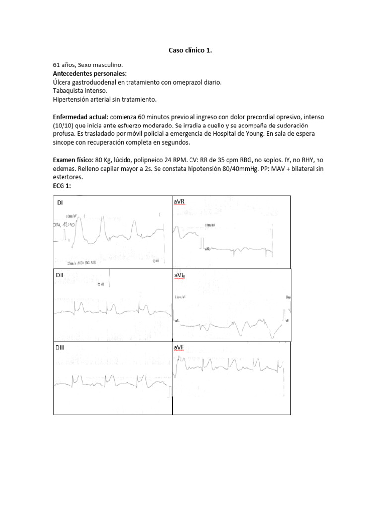 Diagnóstico y Tratamiento de IAM | PDF | Infarto de miocardio ...