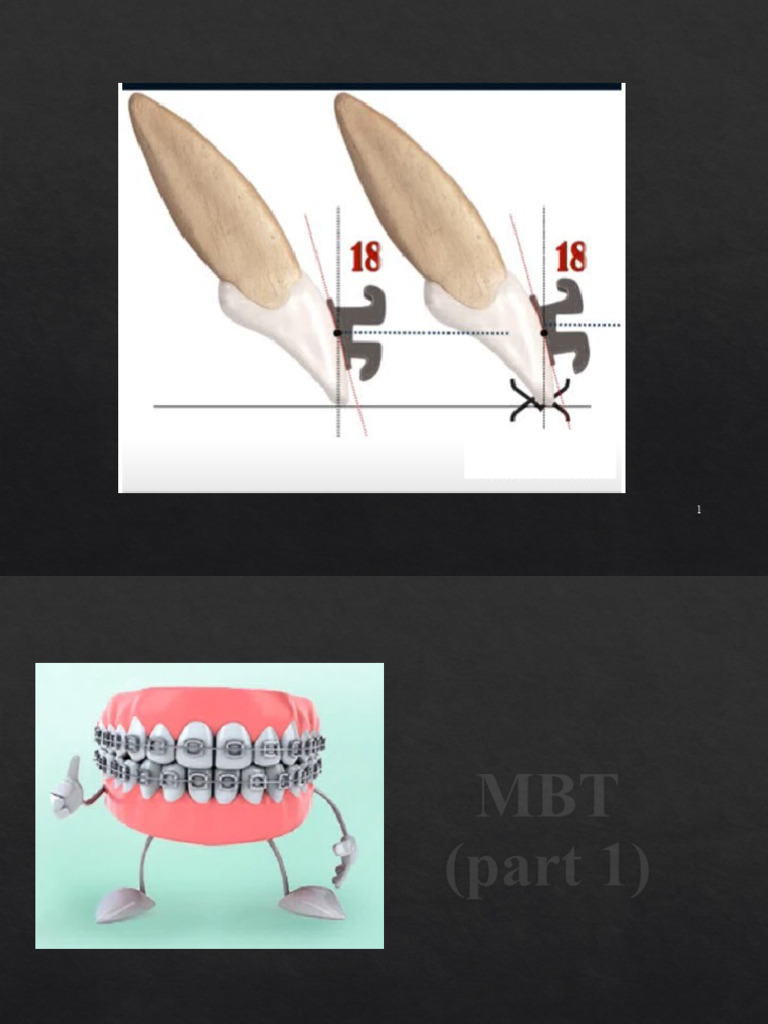 MBT Orthodontic Treatment Mechanics Guide | PDF | Orthodontics | Mouth