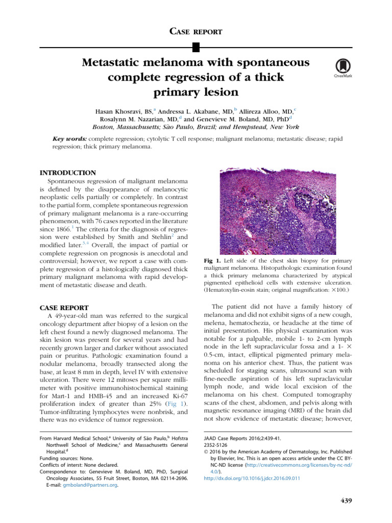 Spontaneous Regression in Melanoma Case | PDF | Melanoma | Metastasis