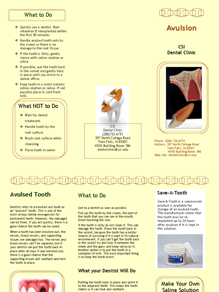 Emergency Care for Avulsed Tooth | PDF | Dentistry | Mouth