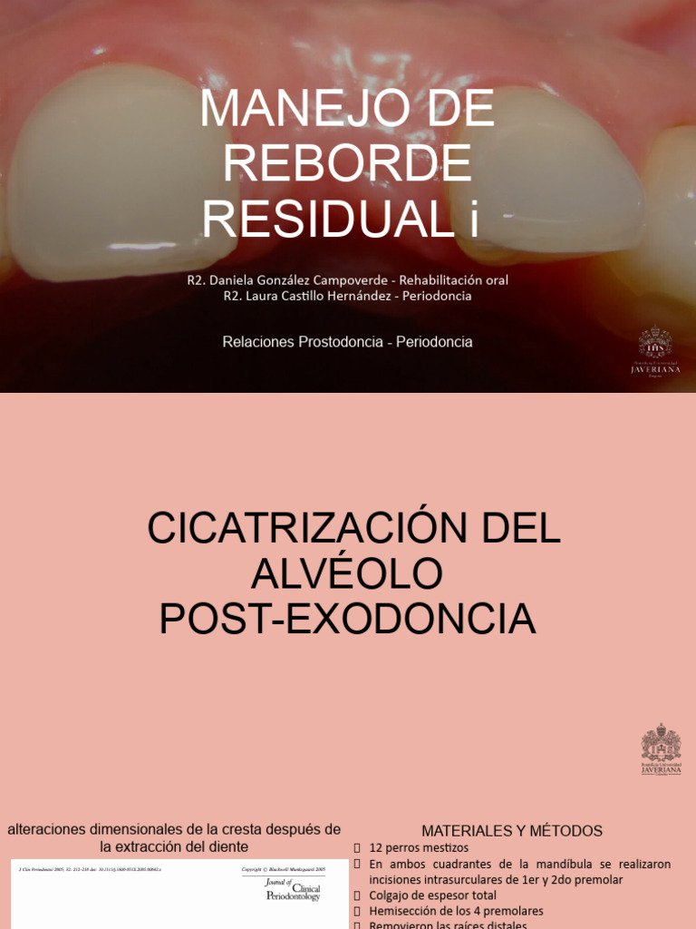 Manejo del Reborde Residual Post-Extracción | PDF | Hueso | Diente