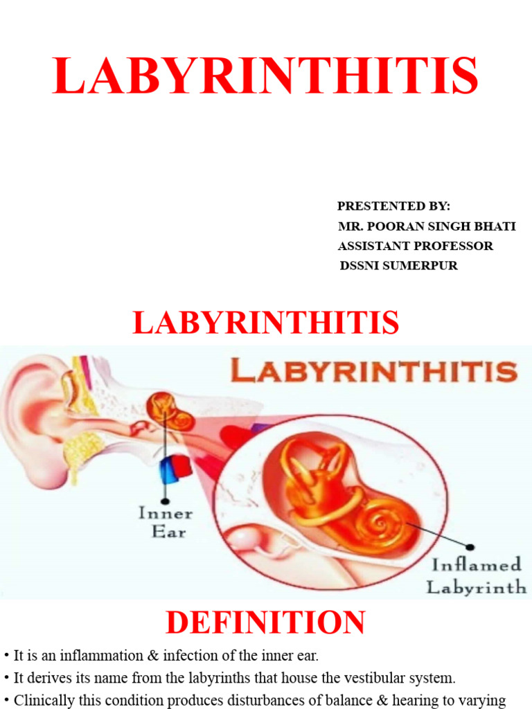 LABYRINTHISTIS | PDF | Vertigo | Neurology