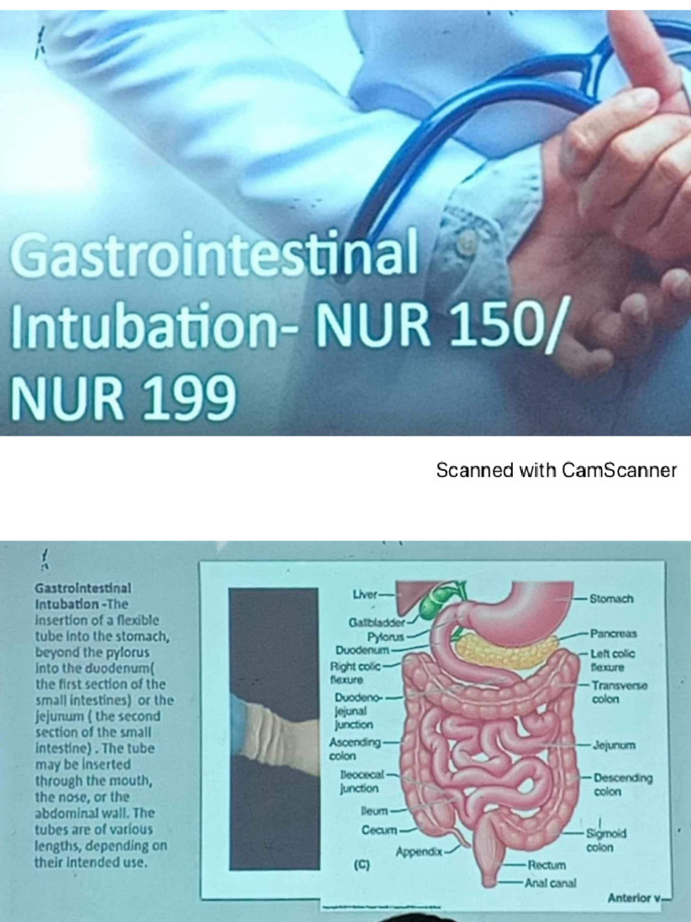 NGT | PDF