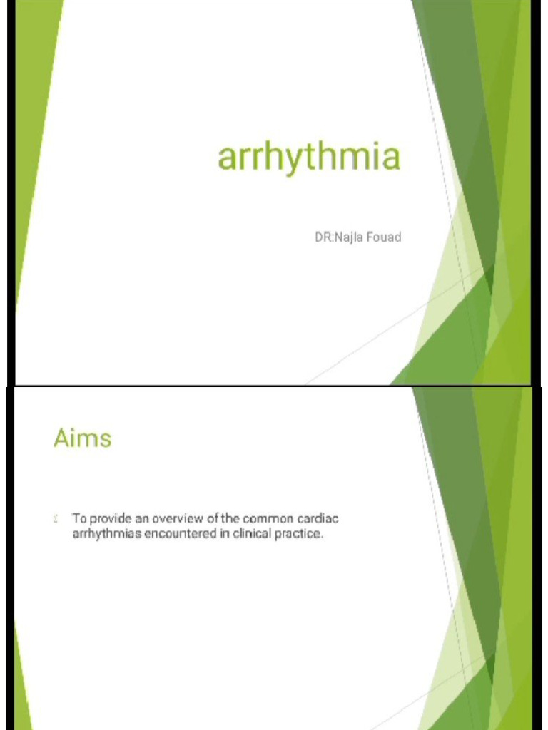 Arrhythmia | PDF
