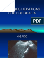 Lesiones Hepaticas Por Ecografia