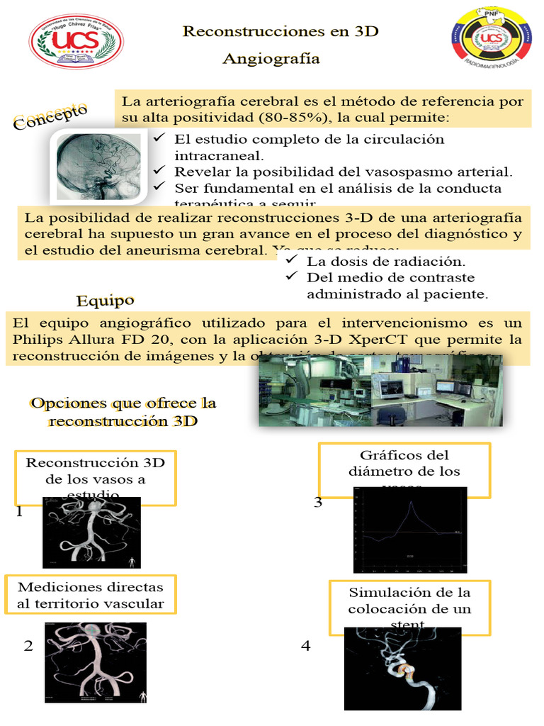 Reconstrucción 3D en Angiografía Cerebral | PDF