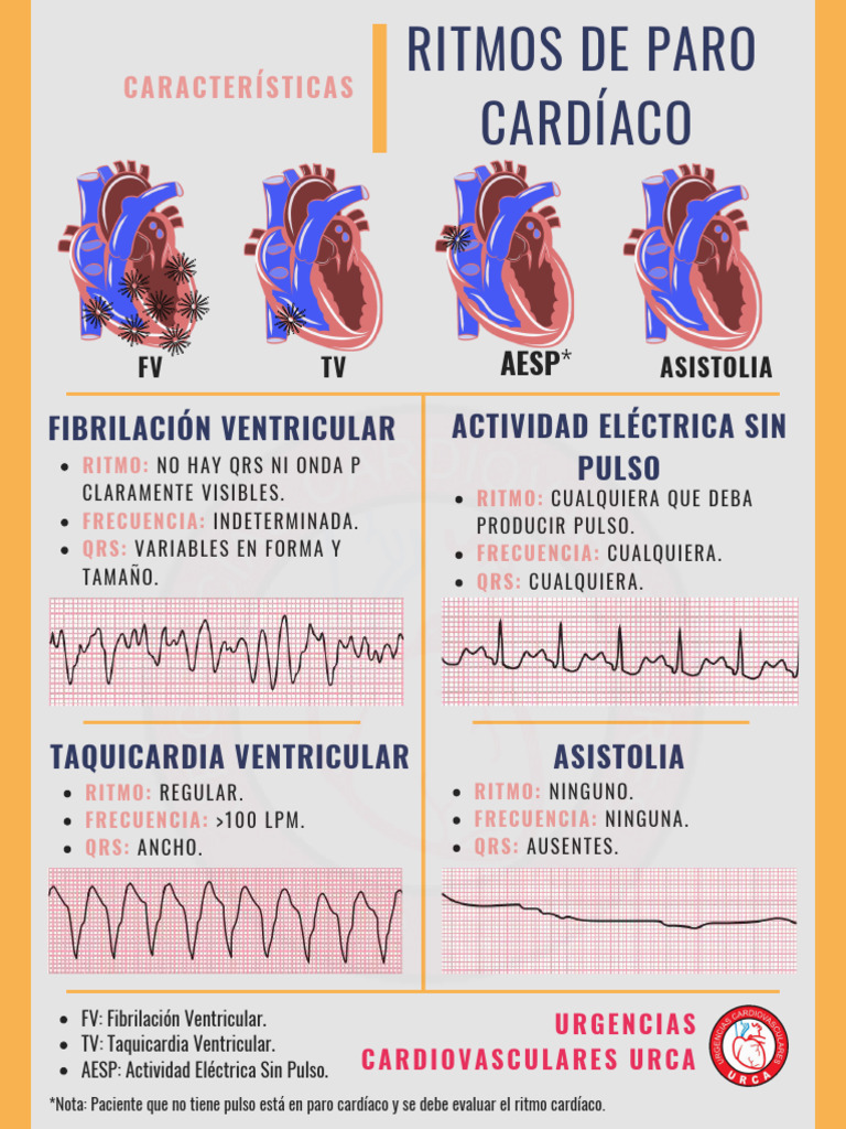 Características de Ritmos Cardíacos Críticos | PDF