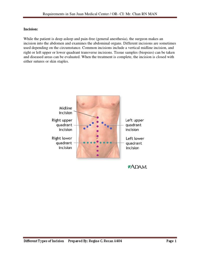 Incision | Abdomen | Surgery
