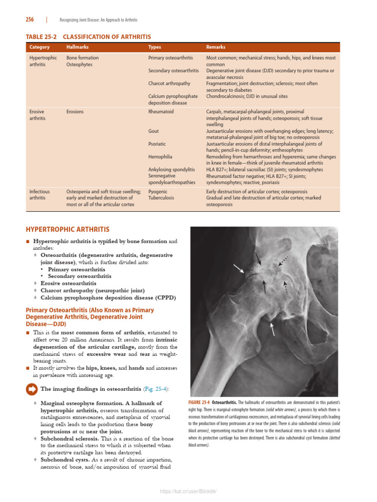 Referensi Osteoarthirtis Pdf Osteoarthritis Joint