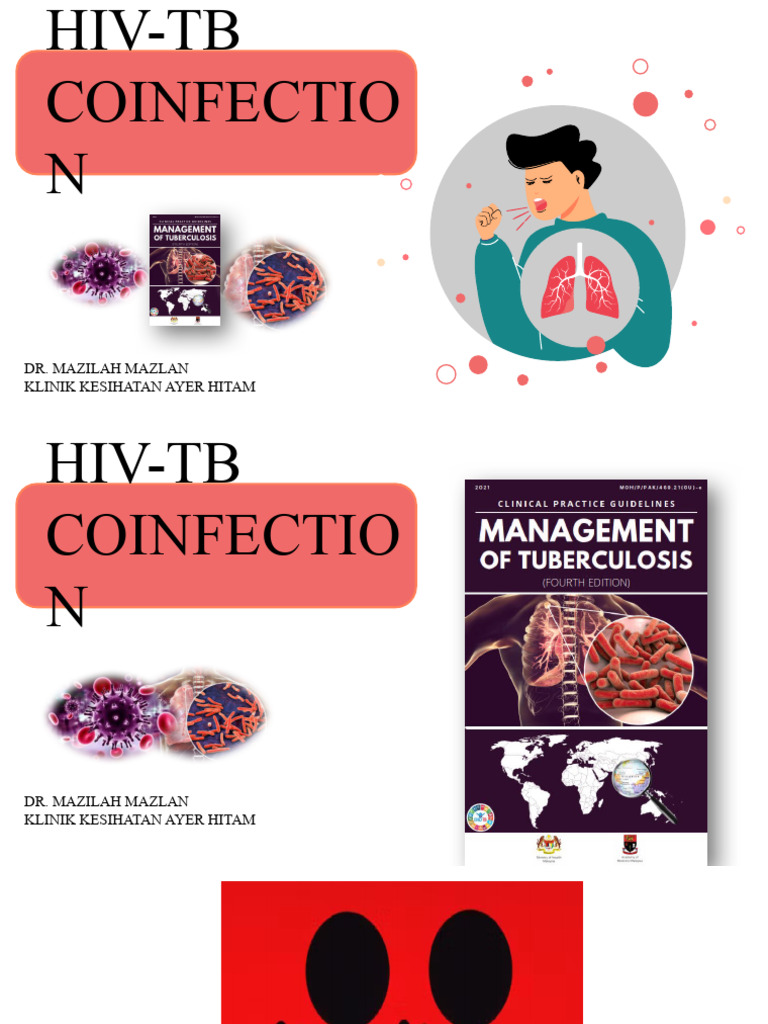 Tb Hiv Coinfection Download Free Pdf Tuberculosis Medical Specialties