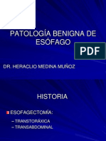 Patologia Benigna de Esofago