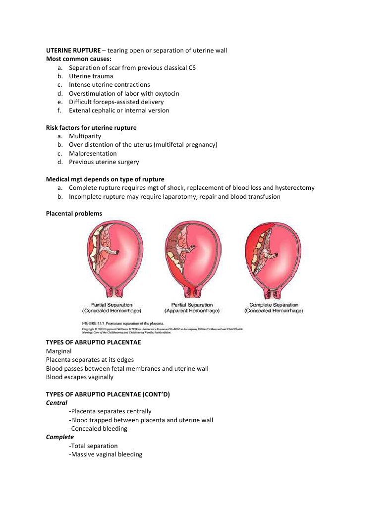 Uterine Rupture: Types and Treatment | PDF