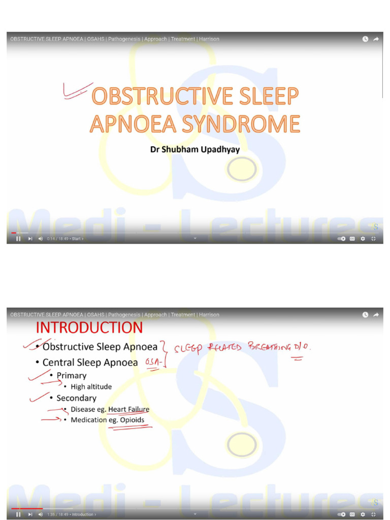 Obstructive Sleep Apnea | PDF
