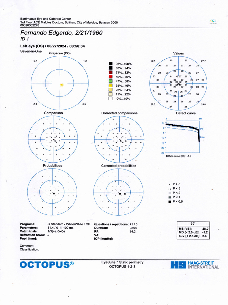 Automated Perimetry Report 3 | PDF