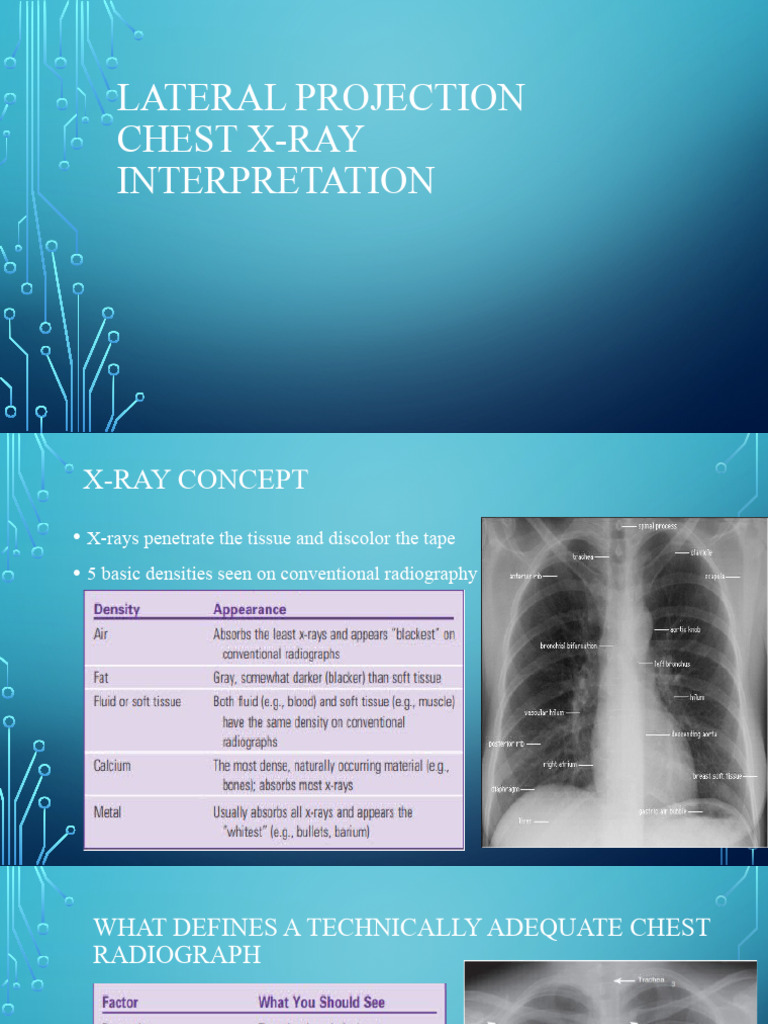 Radiologi Thorax | PDF | Lung | Thorax