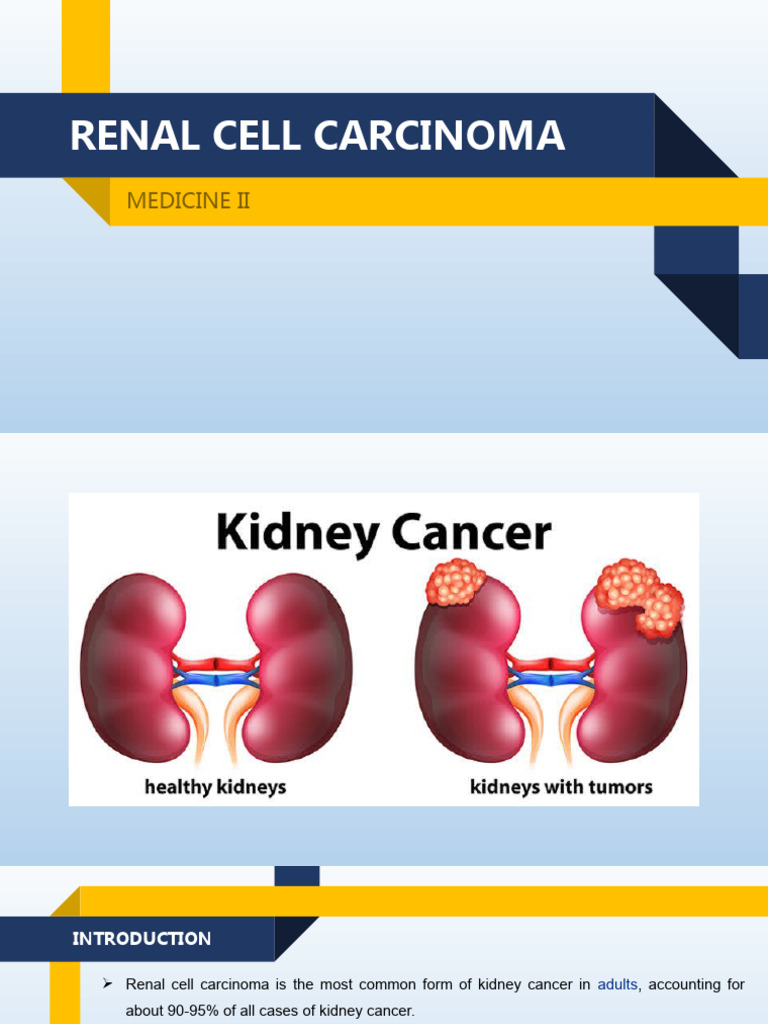 Early Symptoms of Renal Cell Carcinoma | PDF | Cancer | Carcinoma