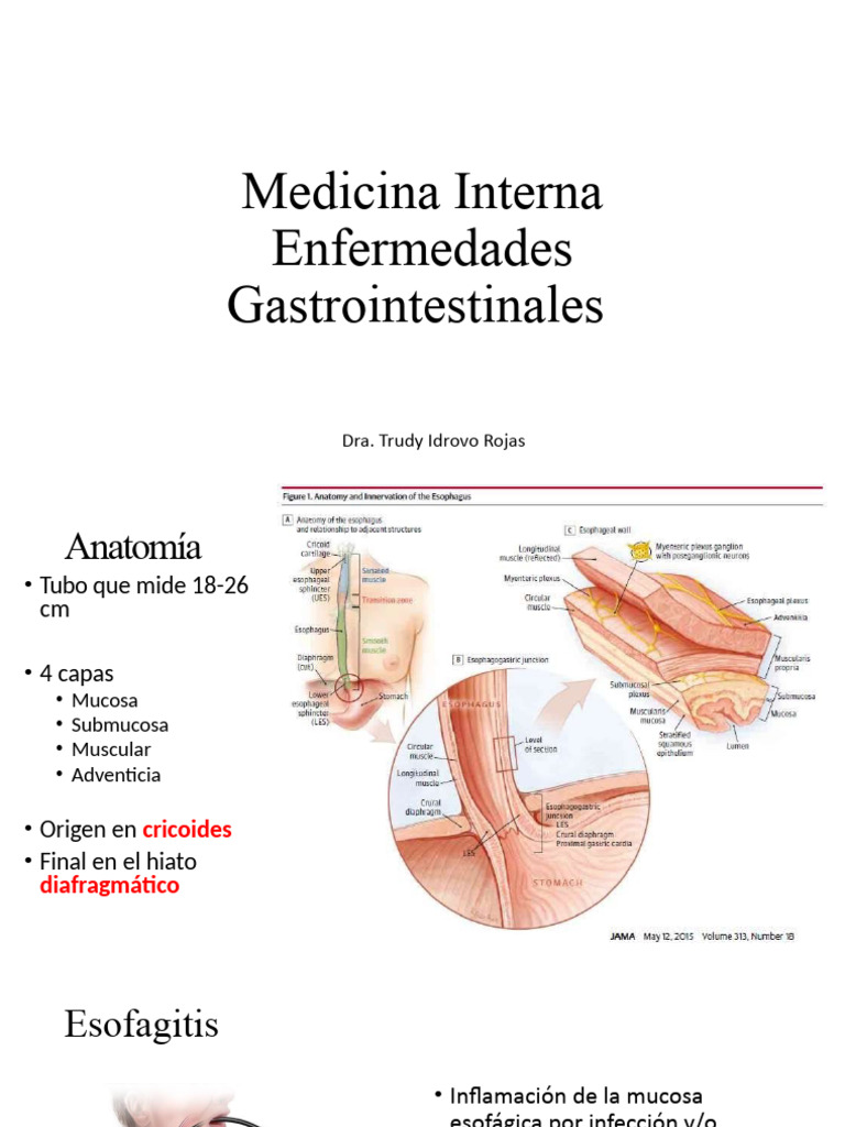 Esofagitis Trudyidrovo | PDF | Acidez | Especialidades Medicas