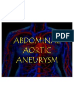 Abdominal Aortic Aneurysm