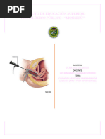 Legrado Uterino Instrumentado y Aspiracion Mecanica Endouterina | PDF ...